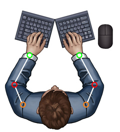 Splayed Keyboard
Eliminates Ulnar Deviation But Can Cause Elbow Abduction -
SeparatedKeyboards.com